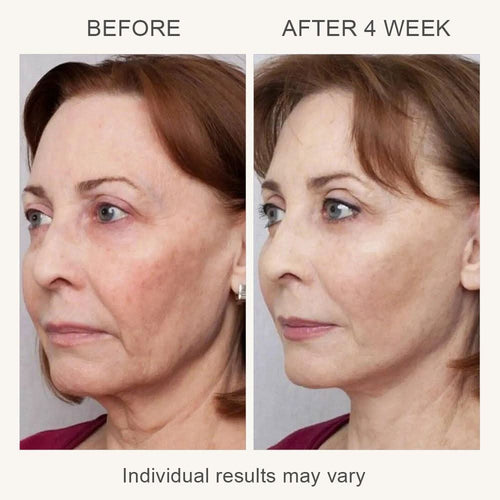 SonoDerm UltraSlim Pro - Professional Ultrasonic Cavitation Body Contouring Device