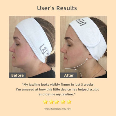 SonoDerm LuminaLift™