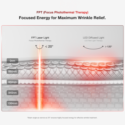 SonoDerm LuxGlow Mask - Professional Laser Light Therapy Face Mask