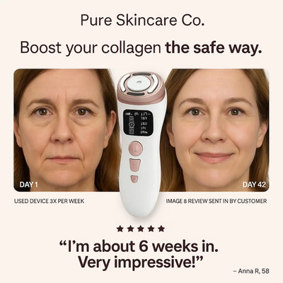 SonoDerm TriLift Elite - 3-in-1 RF+EMS+HIFU Face & Body Tightening System